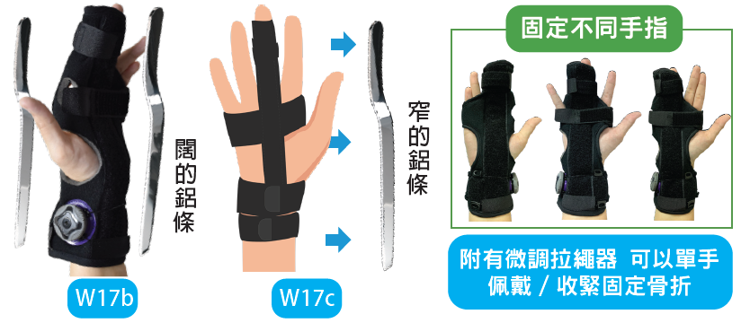 Brace features